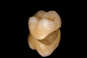 photo_custom-1
