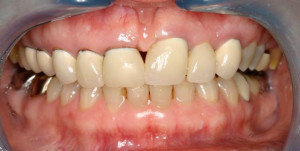 photo_metalfree-4